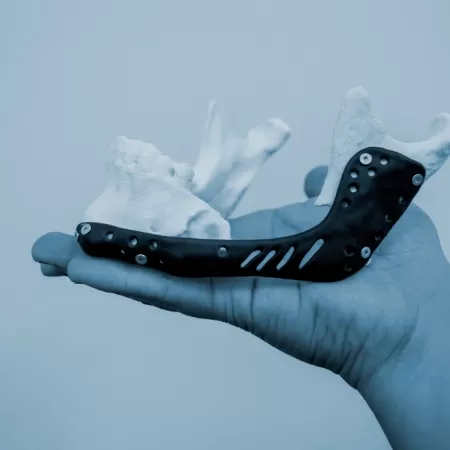 3d Manufacturing In Healthcare 1