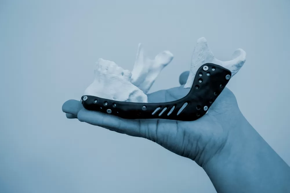 3d Manufacturing In Healthcare 1