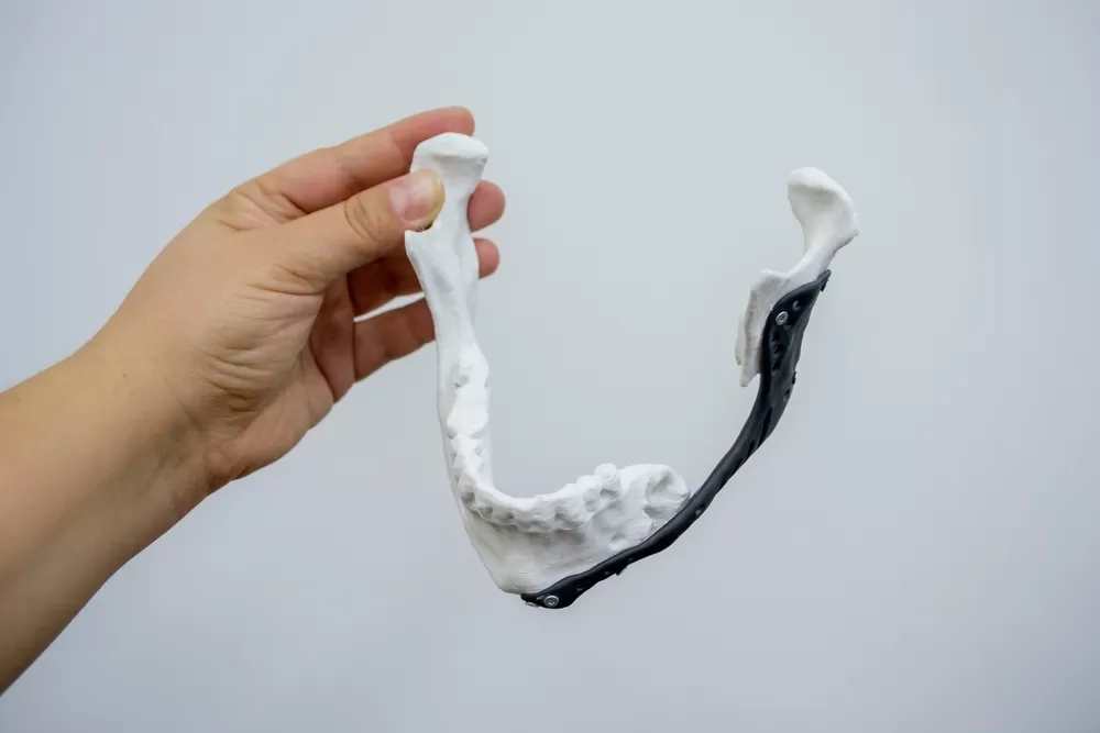 3d Medical Manufacturing Prices