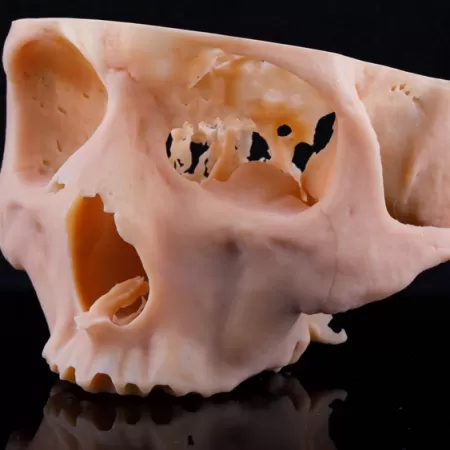 3d Printer Healthcare Sector1