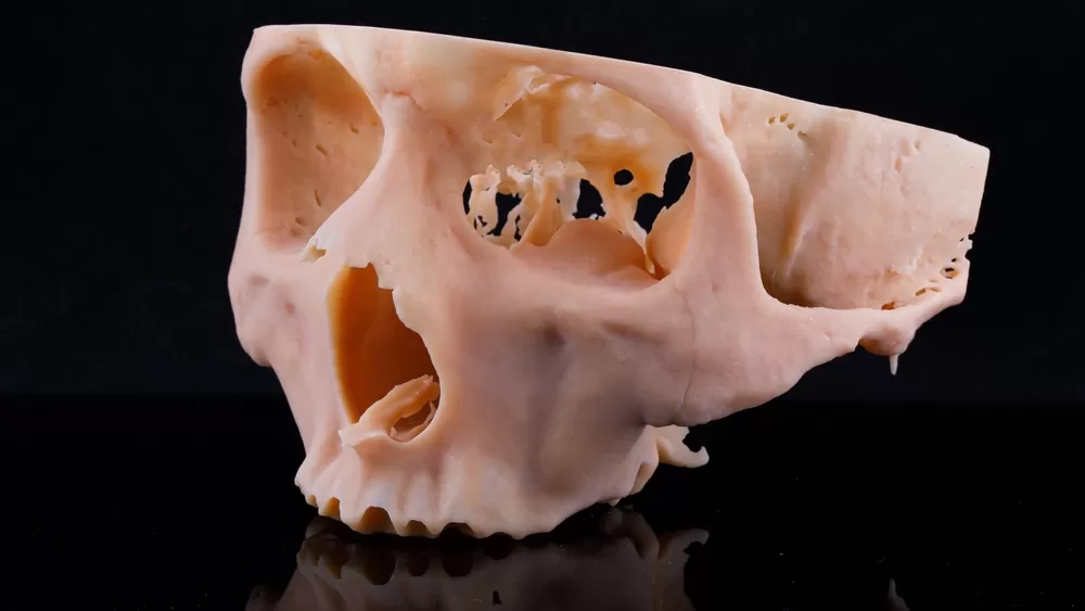 3d Printer Healthcare Sector1