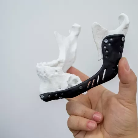3d Printing Medical 2