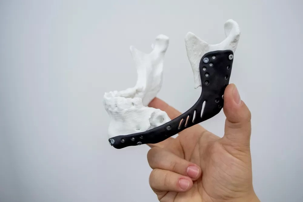 3d Printing Medical 2