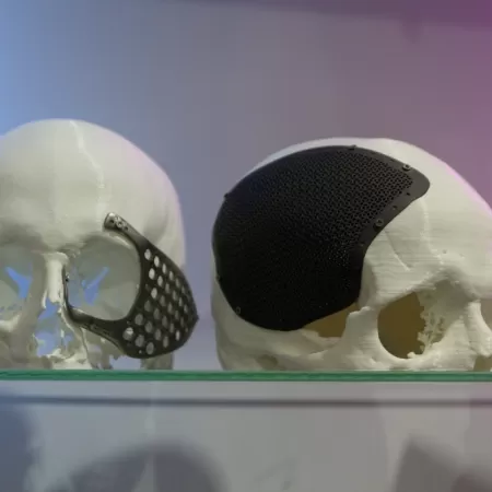 Medical Product Development With 3d Printer