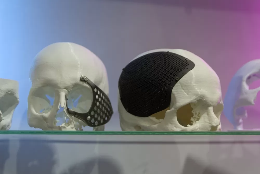 Medical Product Development With 3d Printer